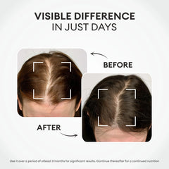 Co Luxury Prosoft Hair Serum | Fortified with Redensyl Promotes Hair Growth & Control Fall  (50 ml)