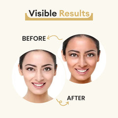 Co Luxury Glutathione Skin Whitening Soap with Kojic acid and Shea Butter- (Pack of 2)