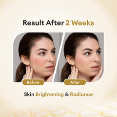 CO Luxury Glutathione Cream for skin lightening with Kojic Acid, Vitamin A, C & E (30 g)