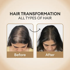 CO LUXURY Foligroin Hair Growth Serum with Procapil, AnaGain, Caffeine, Omega 3 & Rose Extracts - 100 ml