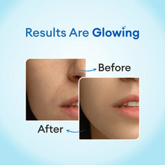 Co luxury Hydra Boost Face Gel 3% Hyaluronic Gel with 2% Niacinamide and 1% Alpha arbutin