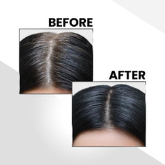 CO LUXURY  Hair Cover-Up Powder for Grey Roots & Bald Spots | Waterproof & Instant Use , Black