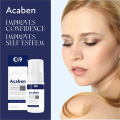 CO LUXURY ACABEN Foaming Facewash | For Acne Prone Skin & Prevent New Acne Breakouts | 2.5% BENZOYL PEROXIDE & 1% SALICYLIC ACID