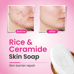 CO Luxury Rice & Ceramide Glass Skin Soap – Nourishing & Moisturizing Bar | Pack of 1 (75g)
